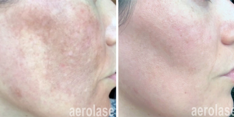 Anti-Aging Medical Spas: Treatments That Help